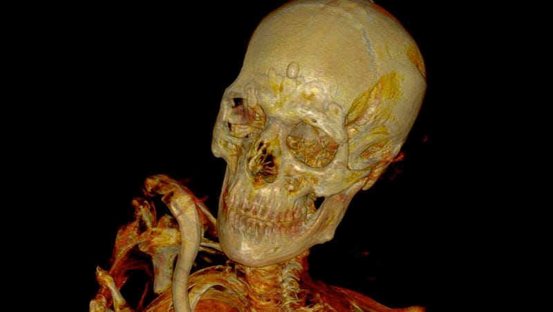 Skeleton of a mummy