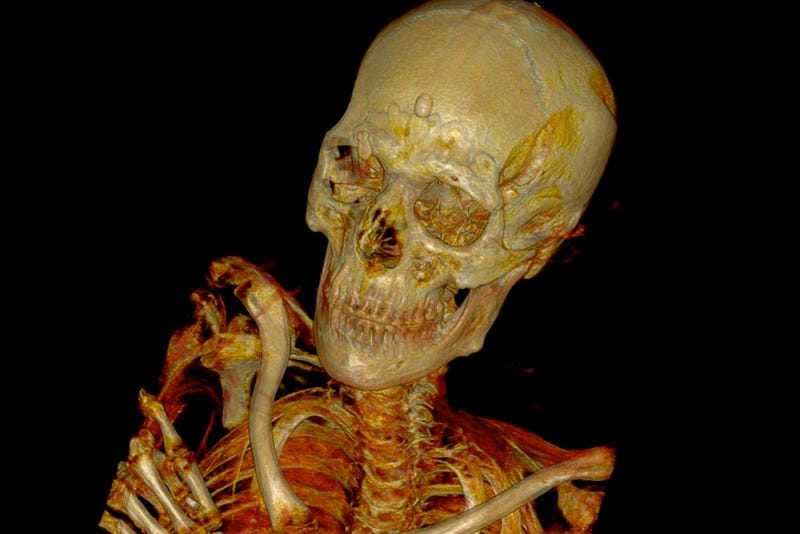 Skeleton of a mummy